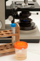 Bladder infections in dogs can be diagnosed with a urinalysis. A urinalysis is s specialized test for diagnosing canine urinary tract infections.